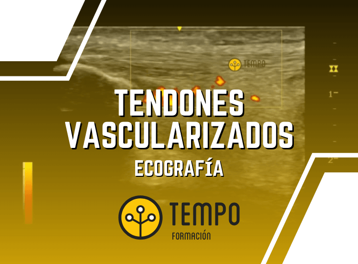 tendones-vascularizados-y-ecografia